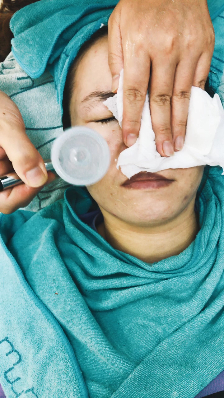 面部注氧～让皮肤喝饱水