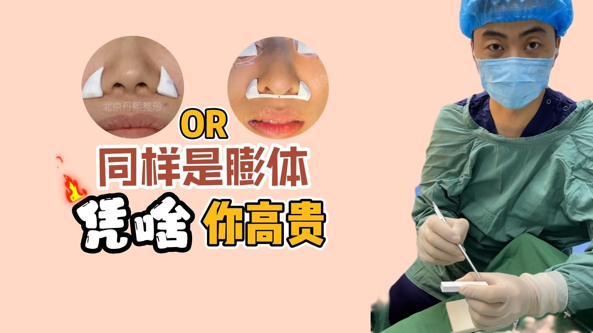 哑铃膨体鼻基底,不移位,改善嘴突.