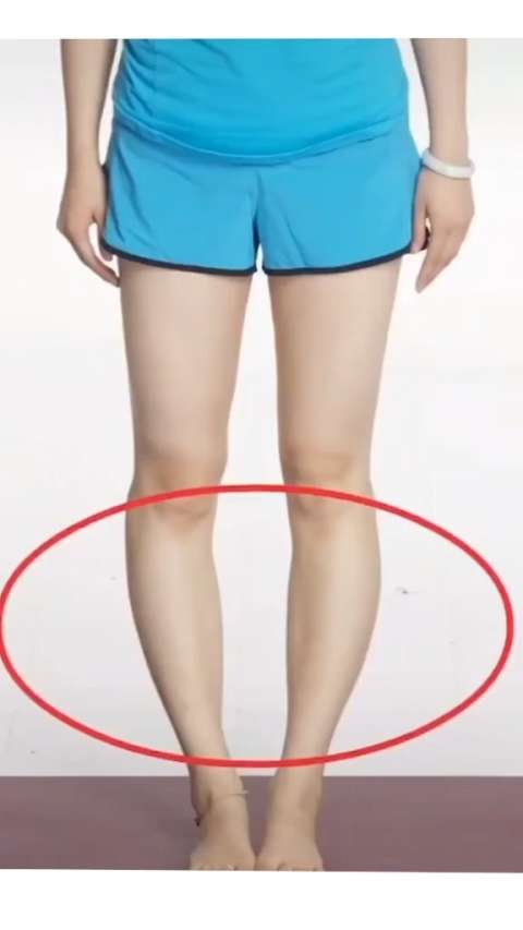 你是不是还在苦恼小腿肌肉外翻?