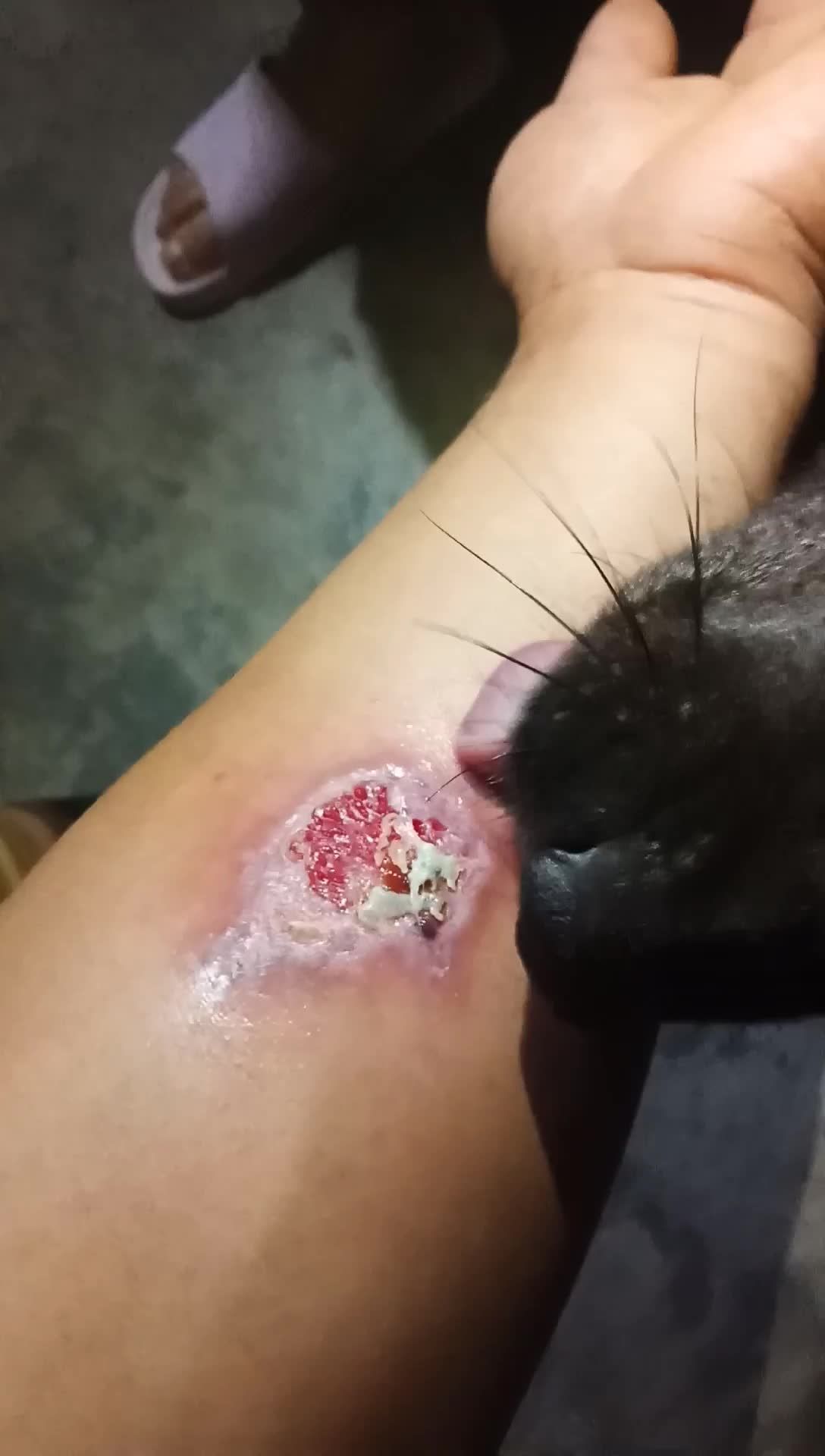 懂事的大妞妞给粑粑舔伤口,爱你78,伴你终生0000