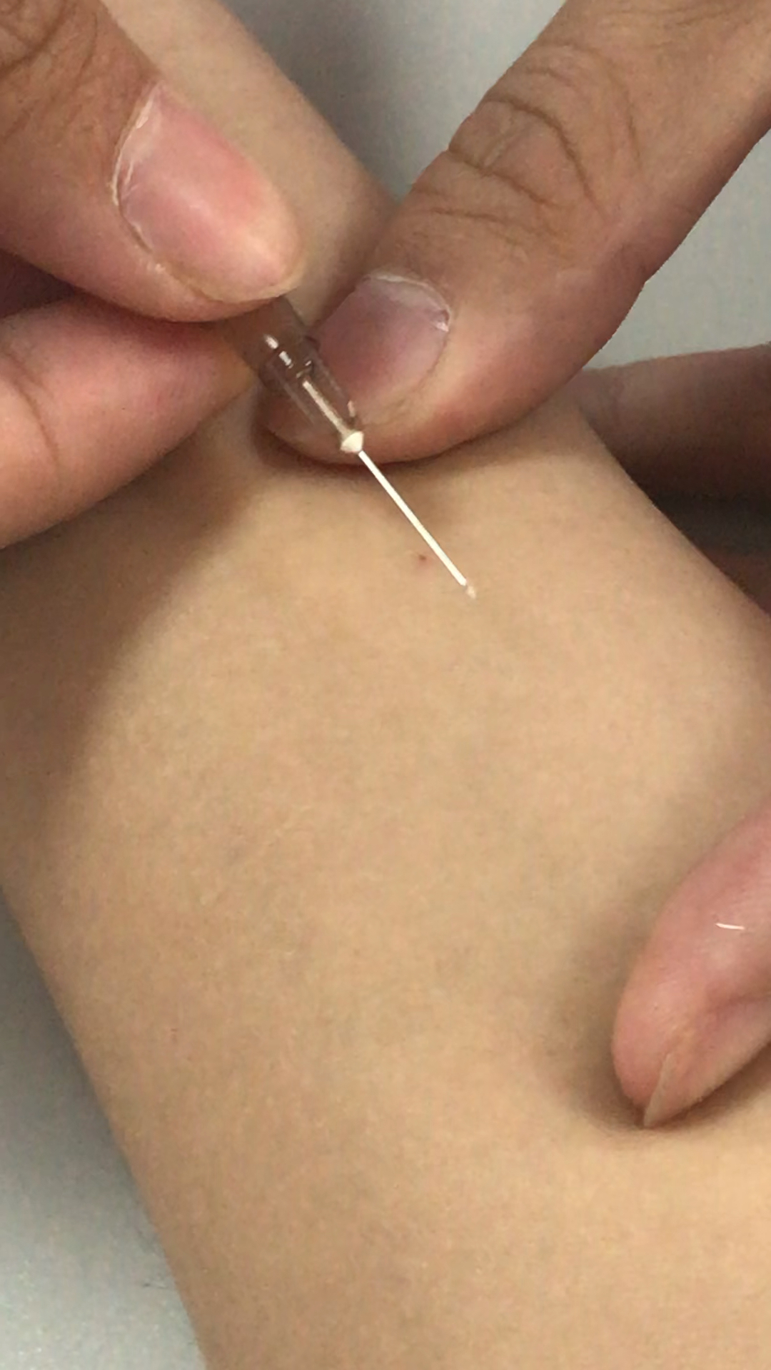 第一次学皮试,勇敢的当了别人的小白鼠,只有自己体会了才知道怎样入针