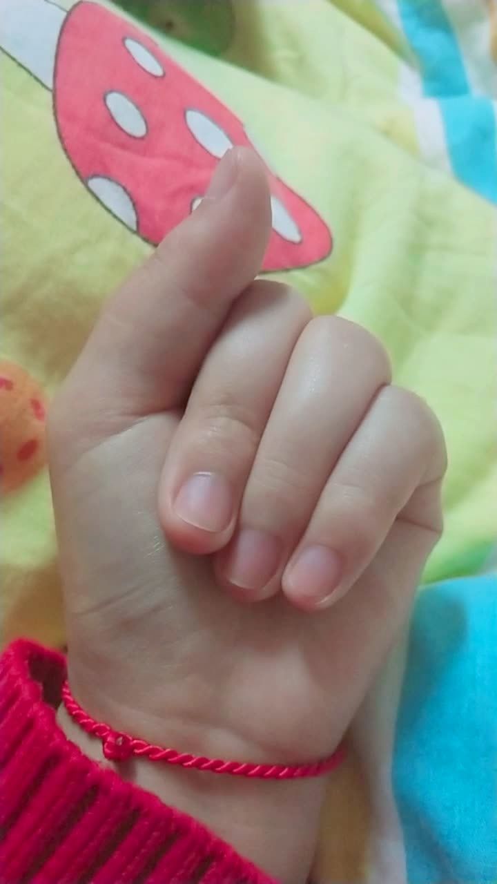 天生四个手指,给我点关心,给点关爱,都说没得,我怎么那么可怜01