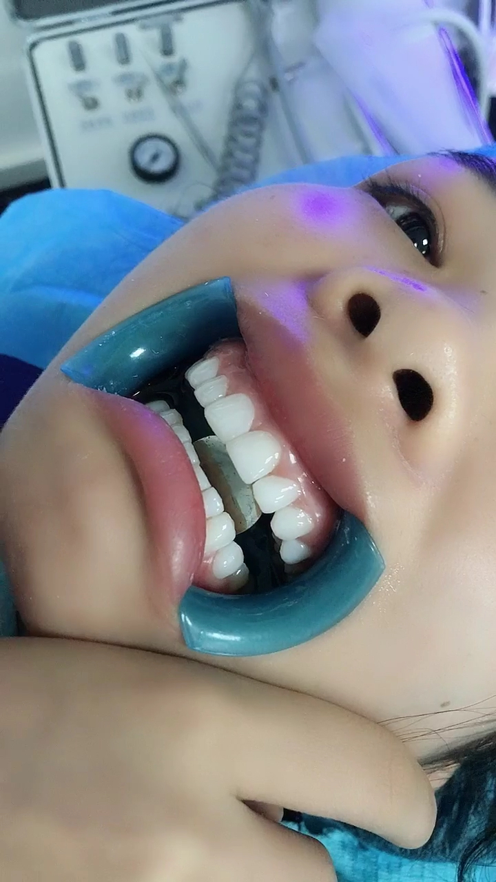 如果你也想拥有一口大白牙,找我!